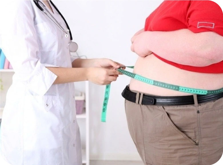 Obesity and bariatric surgery treatment card image