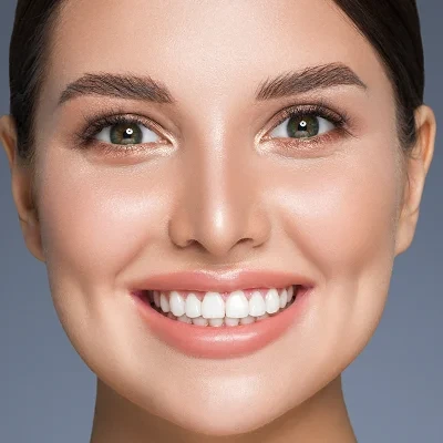 Close-up of a completed full veneer smile