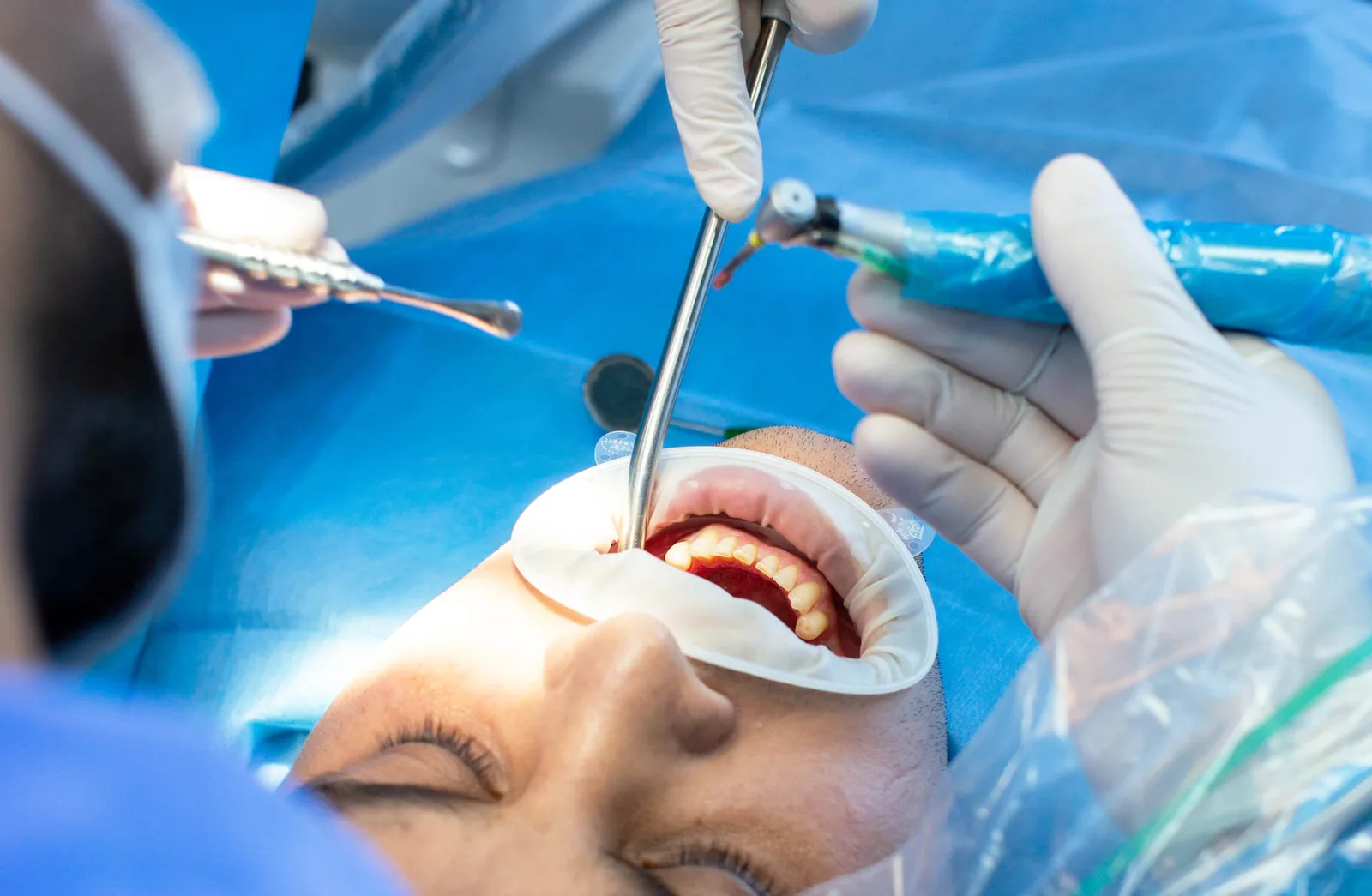 Dental surgery in progress