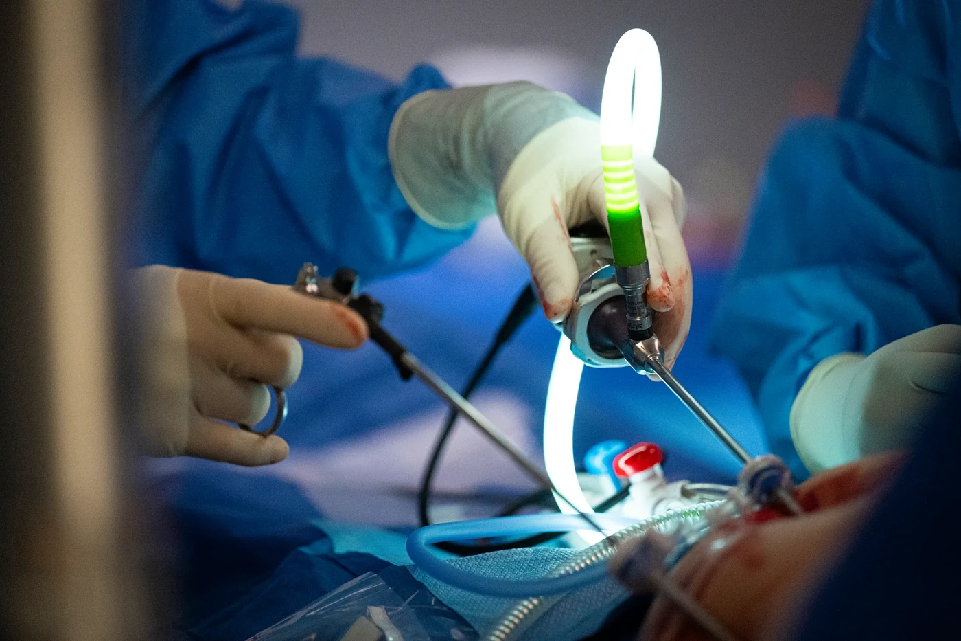 Close-up of the laparoscopic instruments used in keyhole bariatric surgery